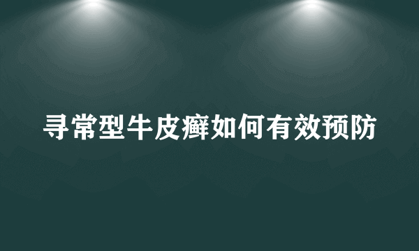 寻常型牛皮癣如何有效预防