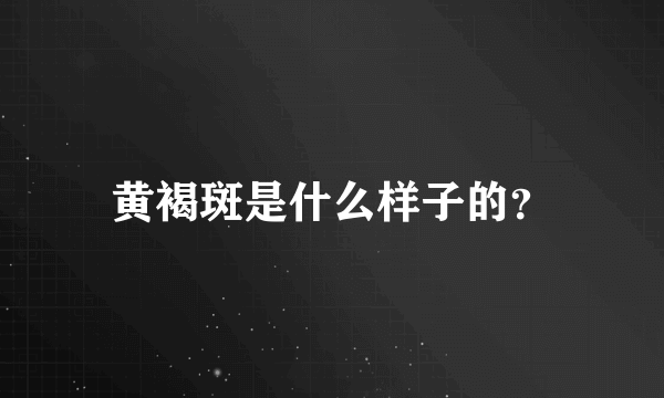 黄褐斑是什么样子的？