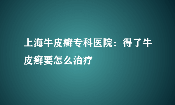 上海牛皮癣专科医院：得了牛皮癣要怎么治疗