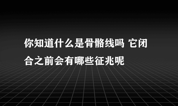 你知道什么是骨骼线吗 它闭合之前会有哪些征兆呢