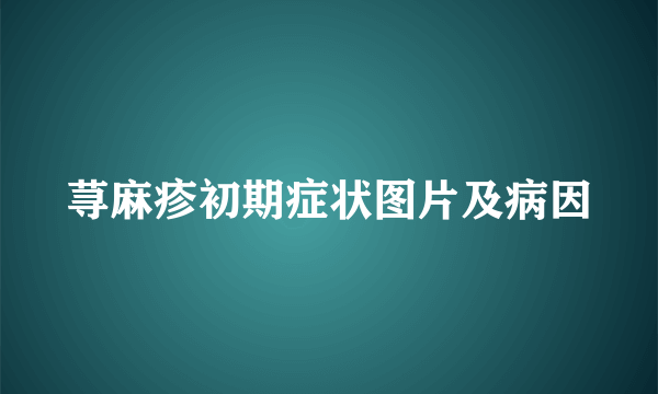 荨麻疹初期症状图片及病因