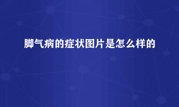 脚气病的症状图片是怎么样的