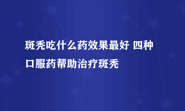 斑秃吃什么药效果最好 四种口服药帮助治疗斑秃