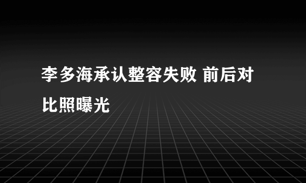 李多海承认整容失败 前后对比照曝光