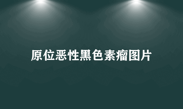 原位恶性黑色素瘤图片