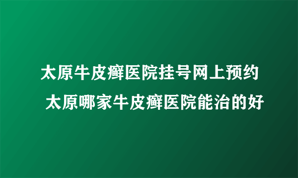 太原牛皮癣医院挂号网上预约 太原哪家牛皮癣医院能治的好