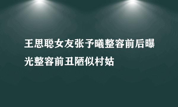 王思聪女友张予曦整容前后曝光整容前丑陋似村姑