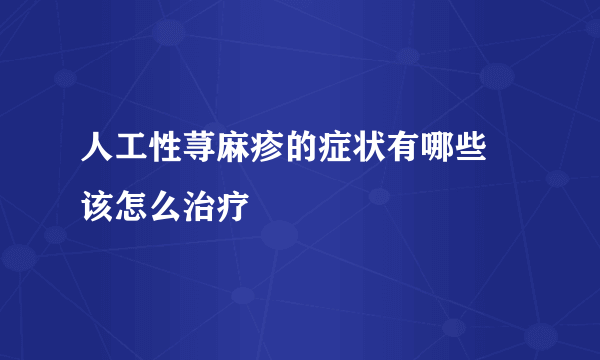 人工性荨麻疹的症状有哪些 该怎么治疗