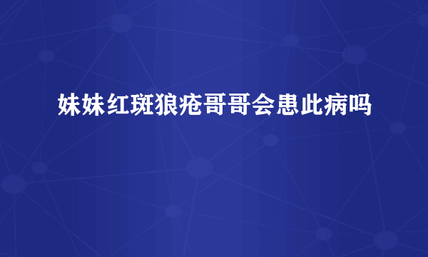 妹妹红斑狼疮哥哥会患此病吗