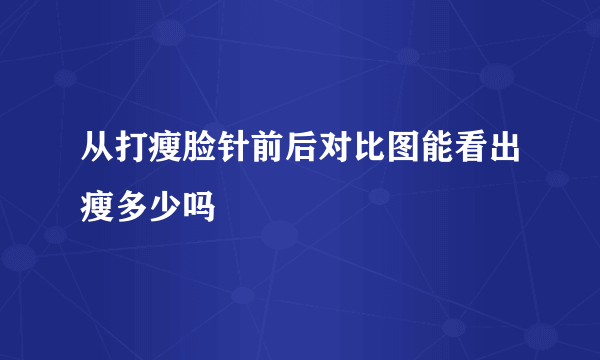 从打瘦脸针前后对比图能看出瘦多少吗