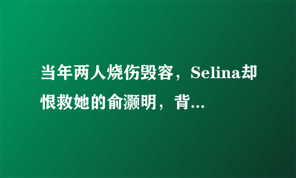 当年两人烧伤毁容，Selina却恨救她的俞灏明，背后到底有什么隐情？