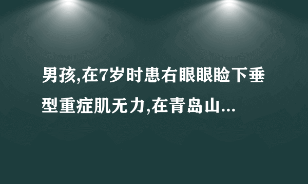 男孩,在7岁时患右眼眼睑下垂型重症肌无力,在青岛山大医院治疗