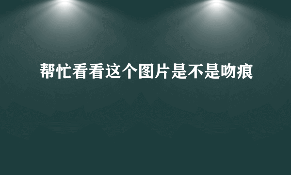 帮忙看看这个图片是不是吻痕