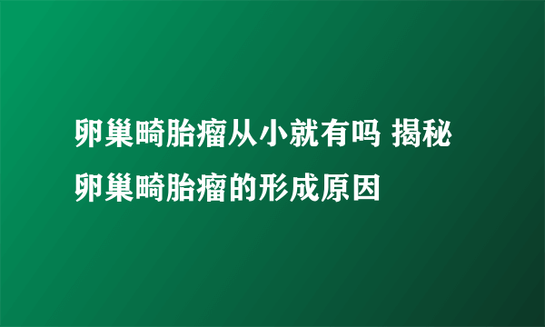 卵巢畸胎瘤从小就有吗 揭秘卵巢畸胎瘤的形成原因