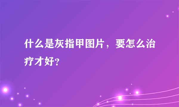 什么是灰指甲图片，要怎么治疗才好？