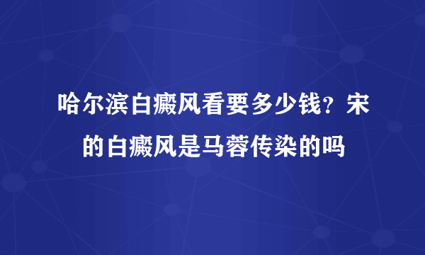 哈尔滨白癜风看要多少钱？宋喆的白癜风是马蓉传染的吗