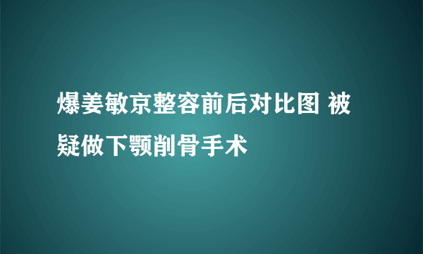 爆姜敏京整容前后对比图 被疑做下颚削骨手术