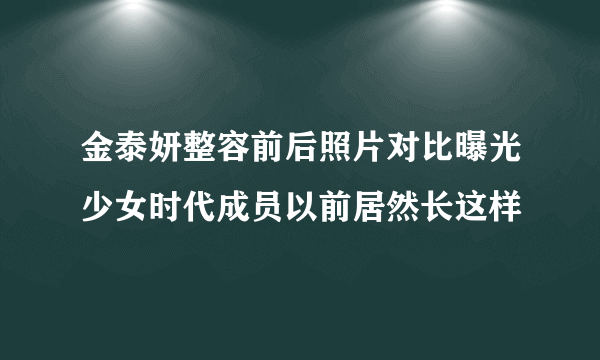 金泰妍整容前后照片对比曝光少女时代成员以前居然长这样