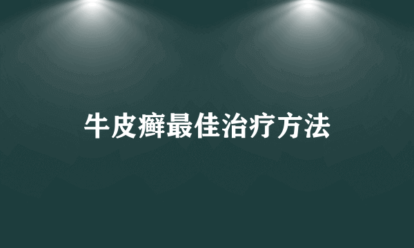 牛皮癣最佳治疗方法