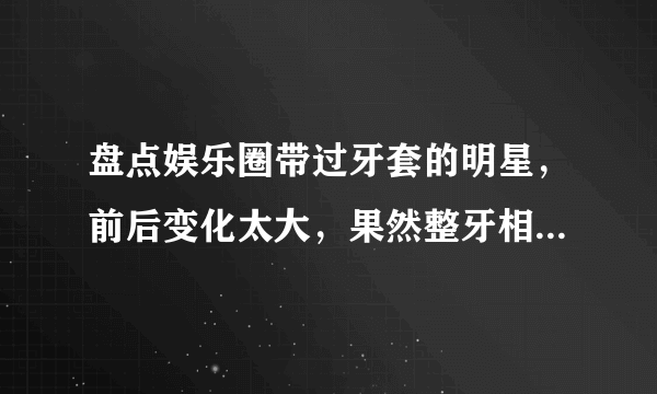 盘点娱乐圈带过牙套的明星，前后变化太大，果然整牙相当于整容