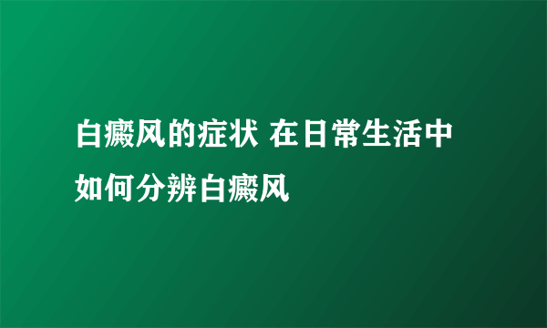 白癜风的症状 在日常生活中如何分辨白癜风