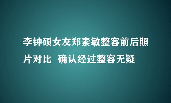 李钟硕女友郑素敏整容前后照片对比  确认经过整容无疑