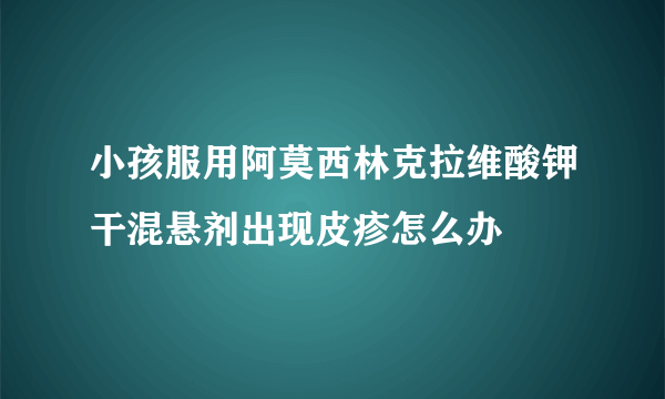 小孩服用阿莫西林克拉维酸钾干混悬剂出现皮疹怎么办