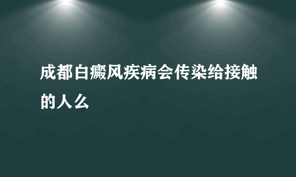 成都白癜风疾病会传染给接触的人么