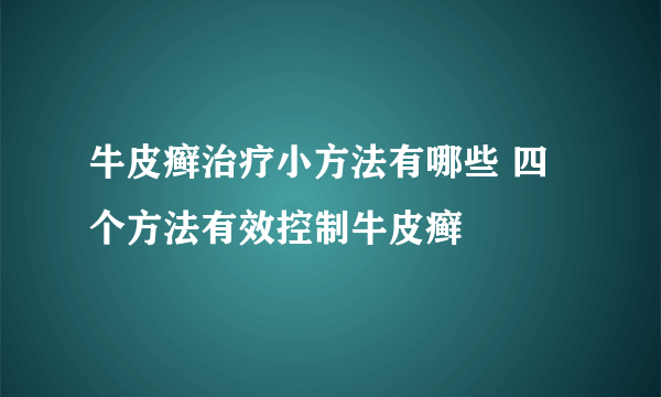 牛皮癣治疗小方法有哪些 四个方法有效控制牛皮癣