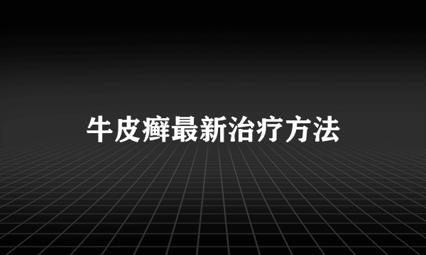 牛皮癣最新治疗方法