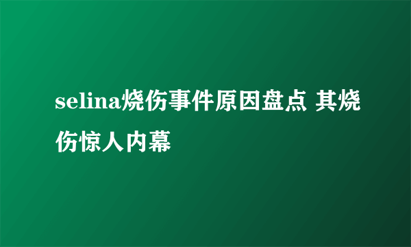 selina烧伤事件原因盘点 其烧伤惊人内幕