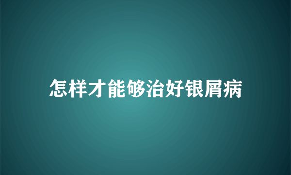 怎样才能够治好银屑病