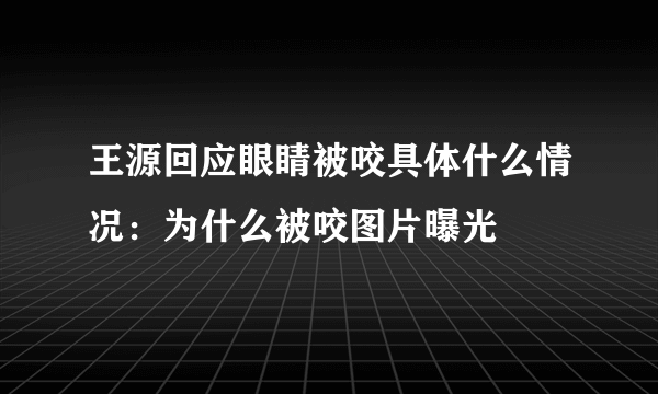 王源回应眼睛被咬具体什么情况：为什么被咬图片曝光