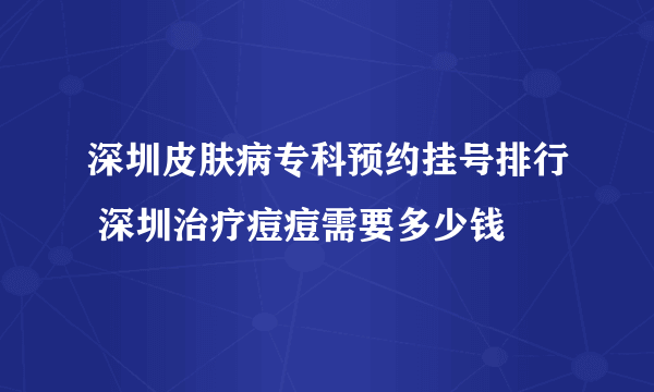 深圳皮肤病专科预约挂号排行 深圳治疗痘痘需要多少钱