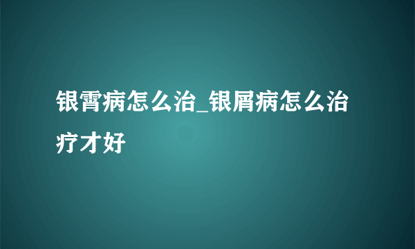 银霄病怎么治_银屑病怎么治疗才好