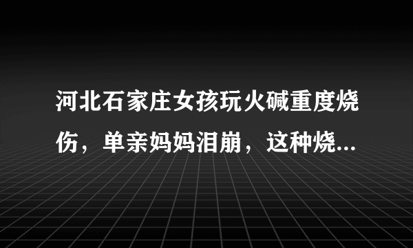 河北石家庄女孩玩火碱重度烧伤，单亲妈妈泪崩，这种烧伤是否可以治疗？