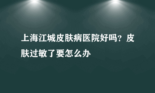 上海江城皮肤病医院好吗？皮肤过敏了要怎么办