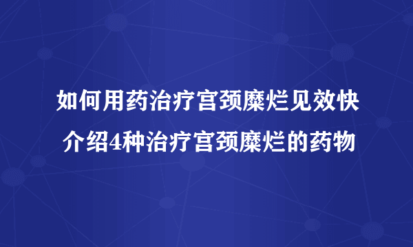 如何用药治疗宫颈糜烂见效快 介绍4种治疗宫颈糜烂的药物