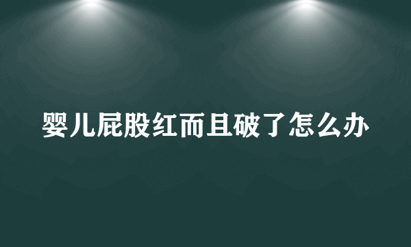 婴儿屁股红而且破了怎么办