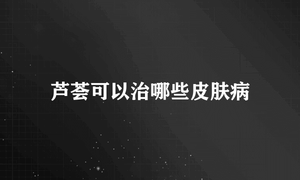 芦荟可以治哪些皮肤病