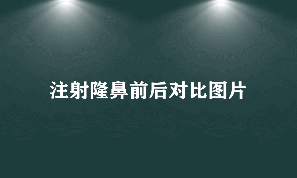 注射隆鼻前后对比图片