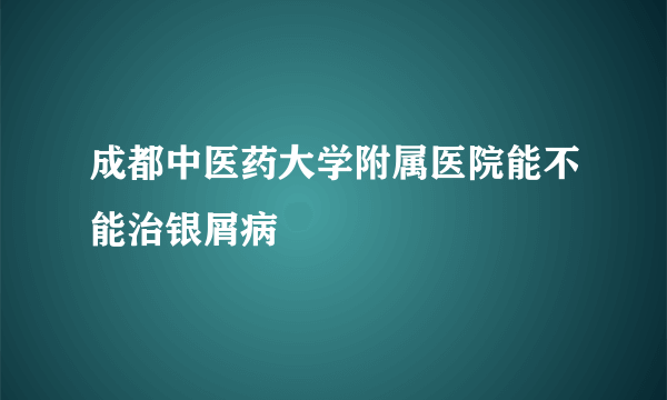 成都中医药大学附属医院能不能治银屑病