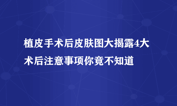 植皮手术后皮肤图大揭露4大术后注意事项你竟不知道