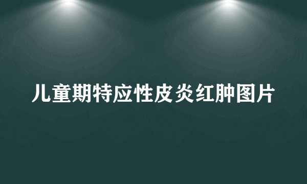 儿童期特应性皮炎红肿图片