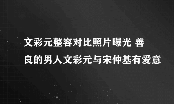 文彩元整容对比照片曝光 善良的男人文彩元与宋仲基有爱意