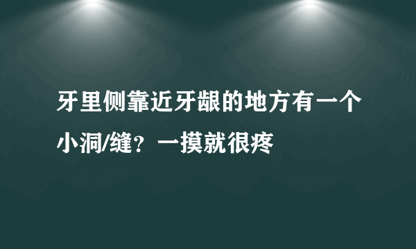 牙里侧靠近牙龈的地方有一个小洞/缝？一摸就很疼