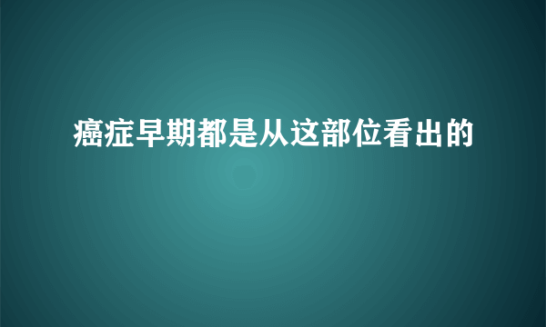 癌症早期都是从这部位看出的