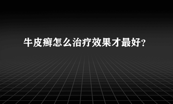 牛皮癣怎么治疗效果才最好？