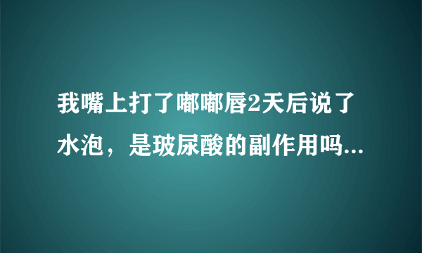 我嘴上打了嘟嘟唇2天后说了水泡，是玻尿酸的副作用吗？还是我自己上火了