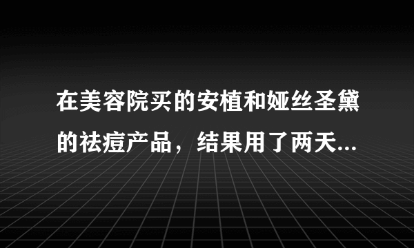 在美容院买的安植和娅丝圣黛的祛痘产品，结果用了两天脸上就脱皮了，这是过敏吗？